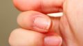 Как раз и навсегда избавиться от заусенцев: проверенные методы и советы