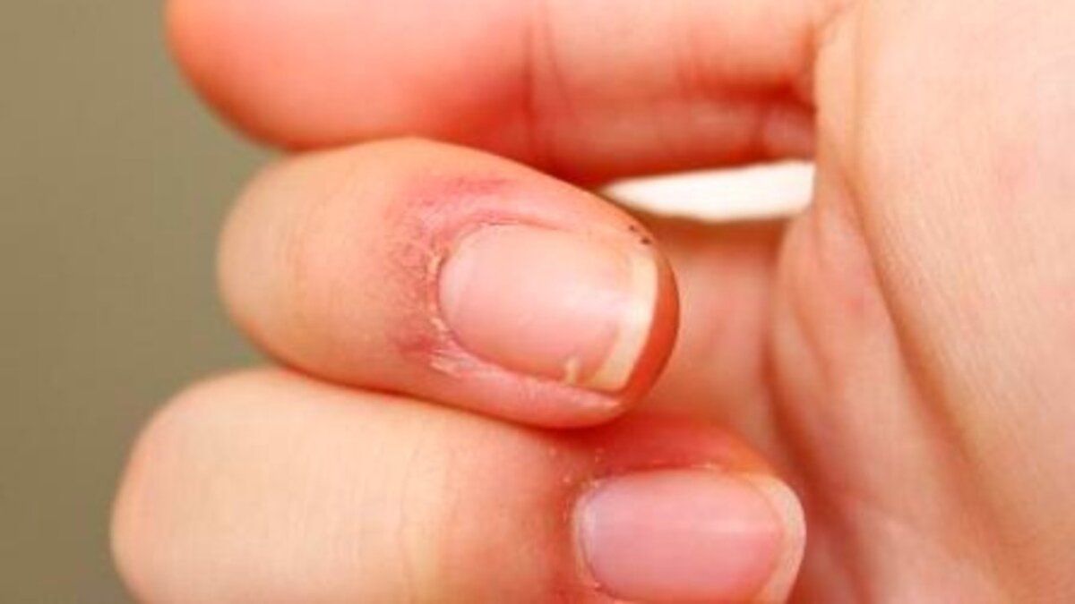 Как раз и навсегда избавиться от заусенцев: проверенные методы и советы