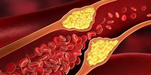 ��� ���� ���� � ���������� � ������: ������� ����������� �����������